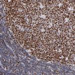 POLA1 Antibody in Immunohistochemistry (IHC)