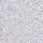 POLA1 Antibody in Immunohistochemistry (IHC)