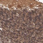 GMFB Antibody in Immunohistochemistry (Paraffin) (IHC (P))