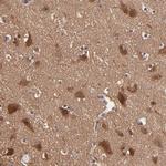 GMFB Antibody in Immunohistochemistry (Paraffin) (IHC (P))