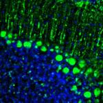 GMFB Antibody in Immunohistochemistry (Paraffin) (IHC (P))