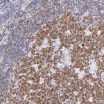 Lrmp Antibody in Immunohistochemistry (Paraffin) (IHC (P))