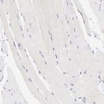 Lrmp Antibody in Immunohistochemistry (Paraffin) (IHC (P))