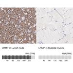 Lrmp Antibody in Immunohistochemistry (IHC)