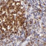 Lrmp Antibody in Immunohistochemistry (IHC)