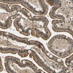 LAMTOR1 Antibody in Immunohistochemistry (Paraffin) (IHC (P))