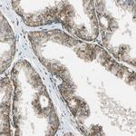 LAMTOR1 Antibody in Immunohistochemistry (Paraffin) (IHC (P))