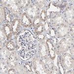 C6orf211 Antibody in Immunohistochemistry (Paraffin) (IHC (P))