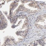 C6orf211 Antibody in Immunohistochemistry (Paraffin) (IHC (P))