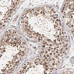 C6orf211 Antibody in Immunohistochemistry (Paraffin) (IHC (P))