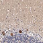 DACT1 Antibody in Immunohistochemistry (Paraffin) (IHC (P))