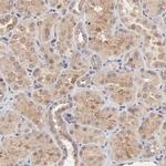 BAIAP2L2 Antibody in Immunohistochemistry (Paraffin) (IHC (P))