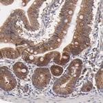 BAIAP2L2 Antibody in Immunohistochemistry (IHC)