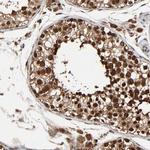 RhoJ Antibody in Immunohistochemistry (IHC)