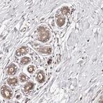 MDP1 Antibody in Immunohistochemistry (Paraffin) (IHC (P))