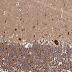 MDP1 Antibody in Immunohistochemistry (Paraffin) (IHC (P))