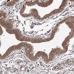 MDP1 Antibody in Immunohistochemistry (Paraffin) (IHC (P))