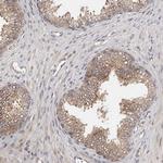 MDP1 Antibody in Immunohistochemistry (Paraffin) (IHC (P))