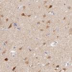 Gephyrin Antibody in Immunohistochemistry (IHC)