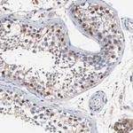 NXF3 Antibody in Immunohistochemistry (Paraffin) (IHC (P))