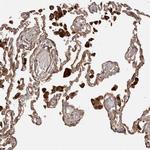 GTPBP1 Antibody in Immunohistochemistry (Paraffin) (IHC (P))