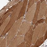 GTPBP1 Antibody in Immunohistochemistry (Paraffin) (IHC (P))