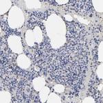 KTN1 Antibody in Immunohistochemistry (Paraffin) (IHC (P))