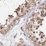 KTN1 Antibody in Immunohistochemistry (Paraffin) (IHC (P))