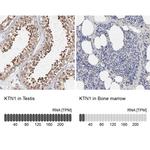 KTN1 Antibody in Immunohistochemistry (IHC)