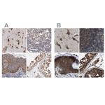 KTN1 Antibody in Immunohistochemistry (IHC)