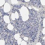 KTN1 Antibody in Immunohistochemistry (IHC)