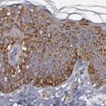 KTN1 Antibody in Immunohistochemistry (IHC)