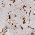 KTN1 Antibody in Immunohistochemistry (IHC)