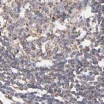 KTN1 Antibody in Immunohistochemistry (IHC)