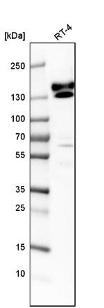 KTN1 Antibody in Western Blot (WB)