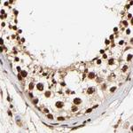 MED12 Antibody in Immunohistochemistry (IHC)