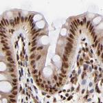 MED12 Antibody in Immunohistochemistry (IHC)