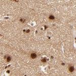 MED12 Antibody in Immunohistochemistry (IHC)