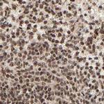 MED12 Antibody in Immunohistochemistry (IHC)