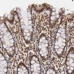 MED12 Antibody in Immunohistochemistry (IHC)