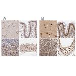 MED12 Antibody in Immunohistochemistry (IHC)