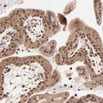 MED12 Antibody in Immunohistochemistry (IHC)