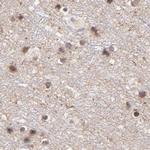 MED12 Antibody in Immunohistochemistry (IHC)