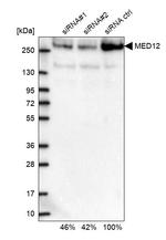 MED12 Antibody in Western Blot (WB)