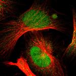 OGFOD1 Antibody in Immunocytochemistry (ICC/IF)