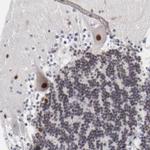 OGFOD1 Antibody in Immunohistochemistry (Paraffin) (IHC (P))