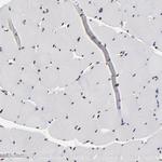 OGFOD1 Antibody in Immunohistochemistry (Paraffin) (IHC (P))