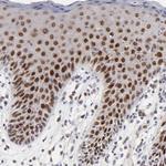 OGFOD1 Antibody in Immunohistochemistry (Paraffin) (IHC (P))