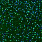 OGFOD1 Antibody in Immunohistochemistry (Paraffin) (IHC (P))