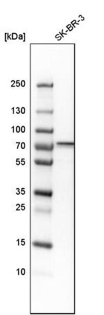 OGFOD1 Antibody in Western Blot (WB)